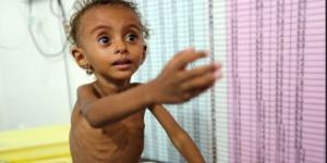 اخبار اليمن | واشنطن: تقرير دولي يتوقع زيادة حالات سوء التغذية الحاد بين الأطفال في اليمن بنسبة 30% هذا العام