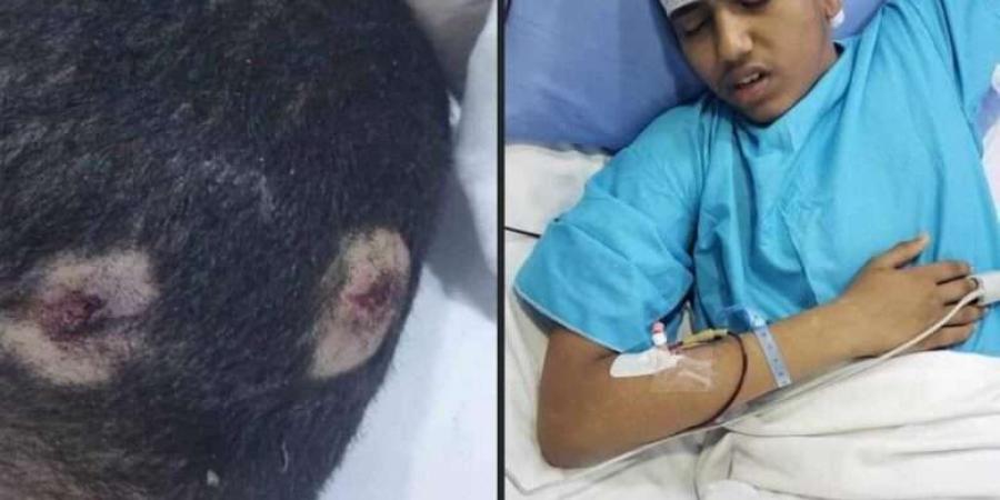 عناصر حوثية تطلق النار على طفل في الحديدة اليمنية
