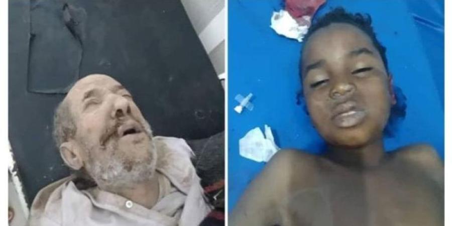 اخبار اليمن | مليشيات الحوثي تستهدف مسعفين المجزرة رداع بقذيفة RPG