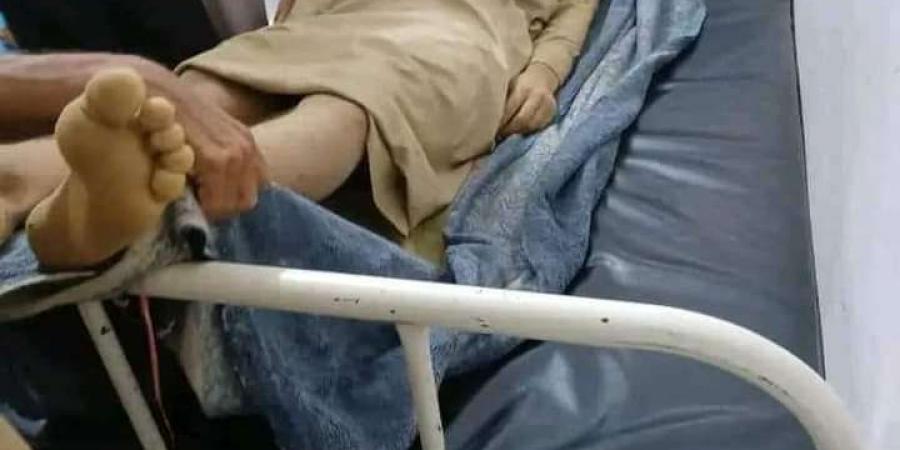 اخبار اليمن الان | وفاة مواطن أثناء القيام بالحفر للبحث عن الكنز بحجة(تفاصيل)