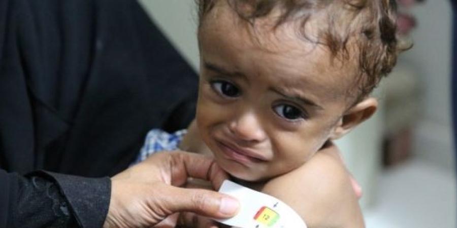 اخبار اليمن | لندن: معدلات سوء التغذية في اليمن هي الأعلى على الإطلاق وطفل يموت كل 10 دقائق بسبب الجوع